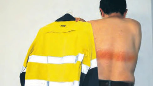 $How to Prevent Burns From Wearing High Visibility Clothing